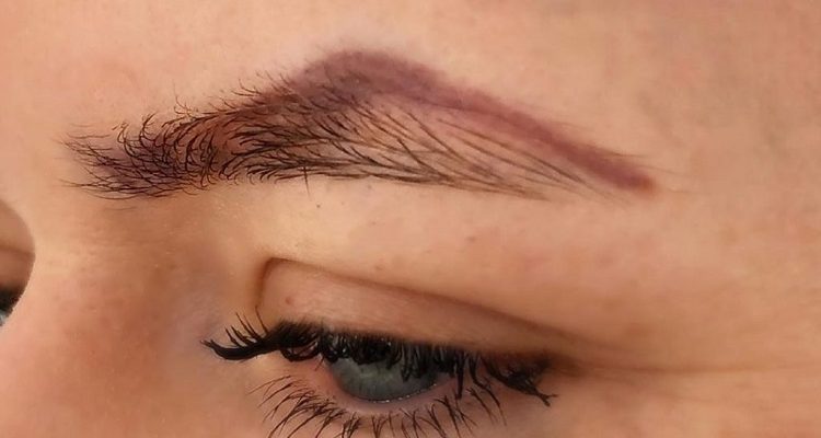 eyebrow-tattoo-removal