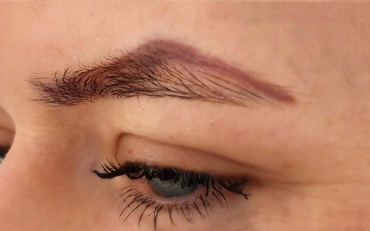 eyebrow-tattoo-removal